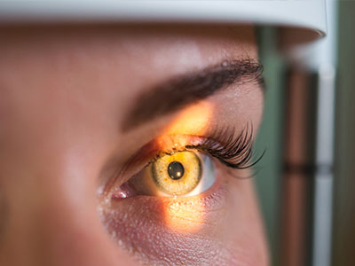 Retina Eye Doctor in Hollywood FL